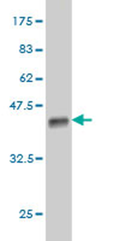 DOT1L monoclonal antibody (M01), clone 6A6