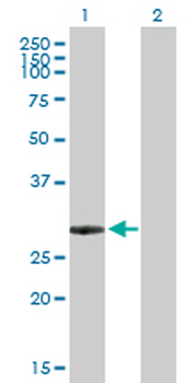 ING5 purified MaxPab mouse polyclonal antibody (B01P)
