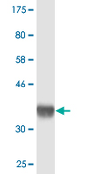 SETDB2 monoclonal antibody (M17), clone 2F4