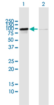 RIOK1 purified MaxPab mouse polyclonal antibody (B02P)