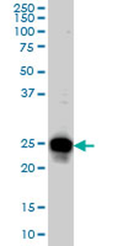 RAB33B monoclonal antibody (M01), clone 6F4