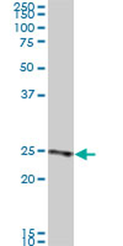RAB33B monoclonal antibody (M01), clone 6F4