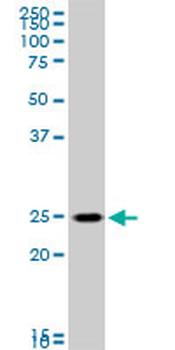 RAB33B monoclonal antibody (M01), clone 6F4
