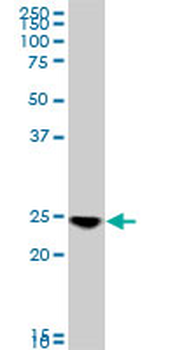 RAB33B monoclonal antibody (M01), clone 6F4