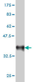 RAB33B monoclonal antibody (M01), clone 6F4