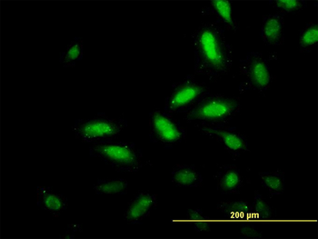 TSC22D4 monoclonal antibody (M07), clone 4G7