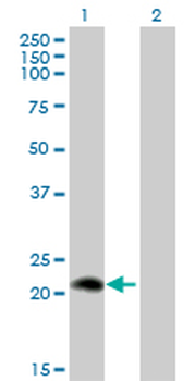 PLA2G12A monoclonal antibody (M01), clone 1D11