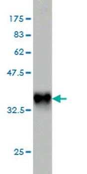 PLA2G12A monoclonal antibody (M01), clone 1D11