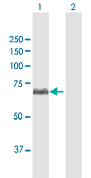 CFHR5 MaxPab rabbit polyclonal antibody (D01)