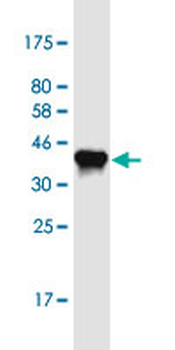 TET1 monoclonal antibody (M01), clone 4F4
