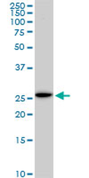 EFHD1 monoclonal antibody (M05), clone 1H7