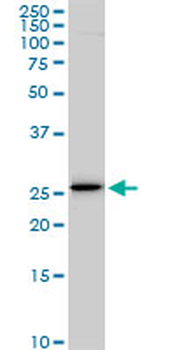 EFHD1 monoclonal antibody (M05), clone 1H7