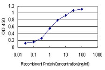 CDK5RAP3 monoclonal antibody (M01), clone 1G4