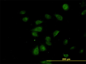 CDK5RAP3 monoclonal antibody (M01), clone 1G4