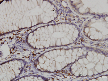 CDK5RAP3 monoclonal antibody (M01), clone 1G4