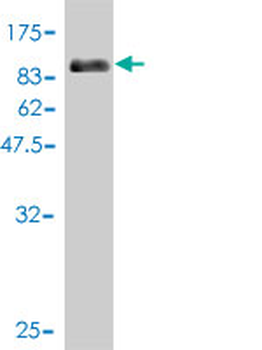 CDK5RAP3 monoclonal antibody (M01), clone 1G4
