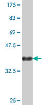 RUFY1 polyclonal antibody (A01)