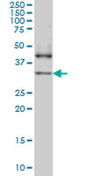 NANOG monoclonal antibody (M01), clone 2C11
