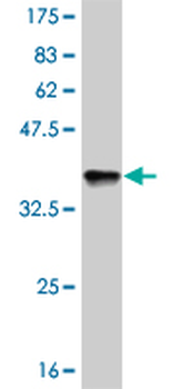 NANOG monoclonal antibody (M01), clone 2C11