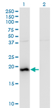 BAALC monoclonal antibody (M01), clone 2A2