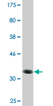 BAALC monoclonal antibody (M01), clone 2A2