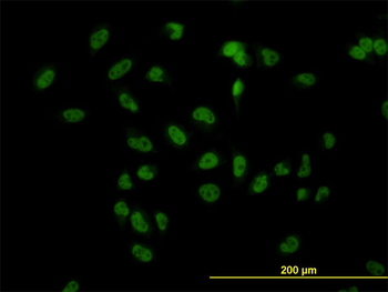 TBL1XR1 monoclonal antibody (M01), clone 3G7