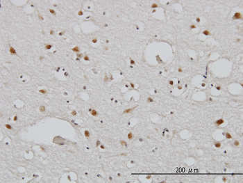 TBL1XR1 monoclonal antibody (M01), clone 3G7