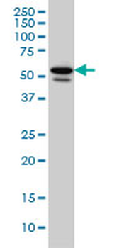 TBL1XR1 monoclonal antibody (M01), clone 3G7