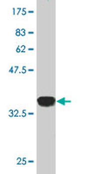 TBL1XR1 monoclonal antibody (M01), clone 3G7