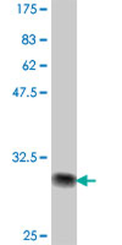 IRX1 polyclonal antibody (A01)