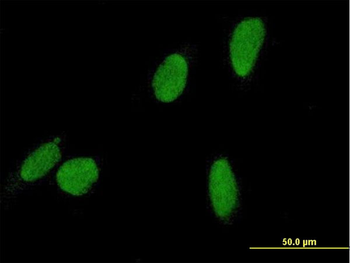 DSCC1 purified MaxPab mouse polyclonal antibody (B01P)