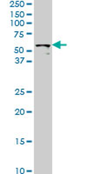 STK33 monoclonal antibody (M06), clone 4F7