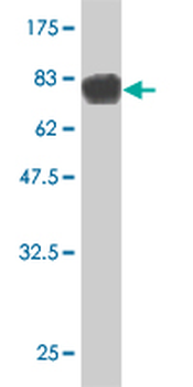 STK33 monoclonal antibody (M06), clone 4F7
