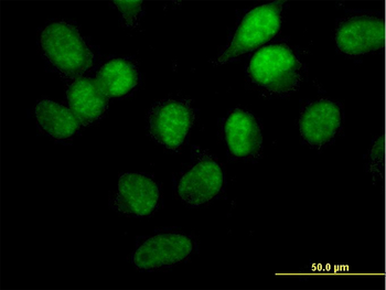STK33 monoclonal antibody (M02), clone 6G1