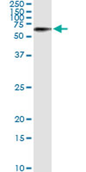 STK33 monoclonal antibody (M02), clone 6G1