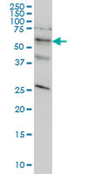 STK33 monoclonal antibody (M02), clone 6G1