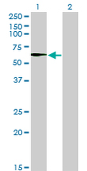 STK33 monoclonal antibody (M02), clone 6G1