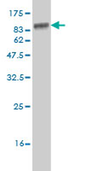 STK33 monoclonal antibody (M02), clone 6G1