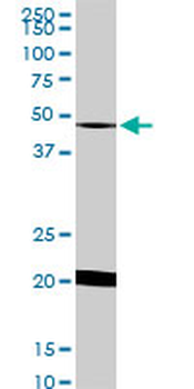 NADK monoclonal antibody (M01), clone 5F4