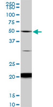 NADK monoclonal antibody (M01), clone 5F4