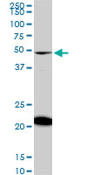 NADK monoclonal antibody (M01), clone 5F4