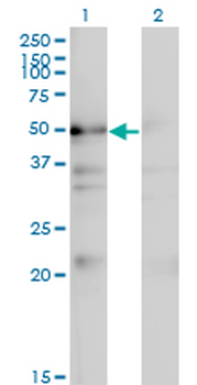 NADK monoclonal antibody (M01), clone 5F4