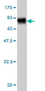 NADK monoclonal antibody (M01), clone 5F4