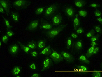 ACD monoclonal antibody (M02), clone 1D8-1B6