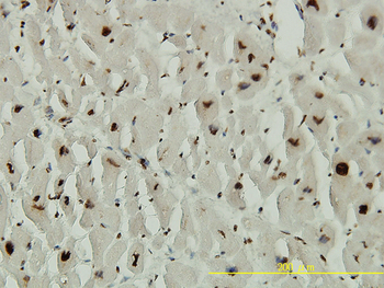 ACD monoclonal antibody (M02), clone 1D8-1B6
