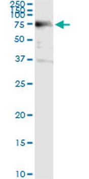 ACD monoclonal antibody (M02), clone 1D8-1B6