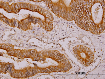 NDRG4 monoclonal antibody (M01), clone 2G3
