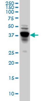 NDRG4 monoclonal antibody (M01), clone 2G3