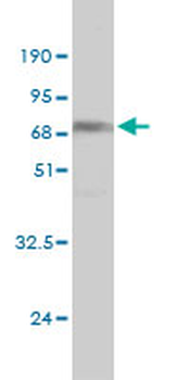 NDRG4 monoclonal antibody (M01), clone 2G3