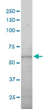 DNAI2 monoclonal antibody (M01), clone 1C8